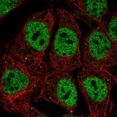 Immunocytochemistry/ Immunofluorescence: OCT1 Antibody [NBP2-56190]