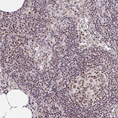 Immunohistochemistry: OCT1 Antibody [NBP2-39024]