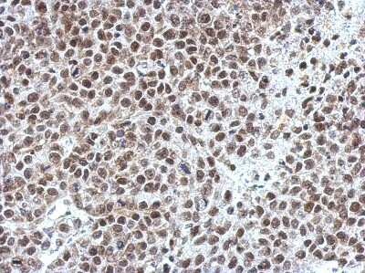 Immunohistochemistry-Paraffin: OCT1 Antibody [NBP2-21584]