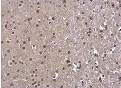 Immunohistochemistry-Paraffin: OCT1 Antibody [NBP2-21584]