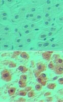 Immunohistochemistry-Paraffin: OCT1 Antibody [NBP2-24677]