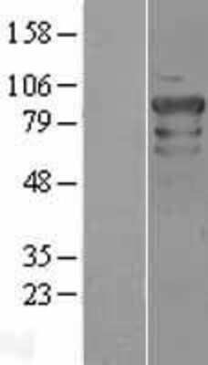 Western Blot: OCT1 Overexpression Lysate [NBL1-14617]