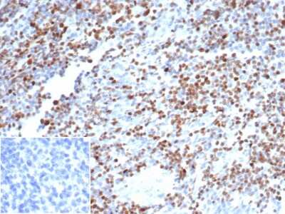 Immunohistochemistry-Paraffin: POU2F2 Antibody (OCT2/7073R) [NBP3-13743]