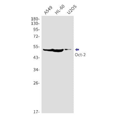 Western Blot: OCT2 Antibody (S02-5E7) [NBP3-14869]