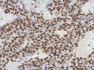 Immunohistochemistry-Paraffin: OCT4 Antibody (486) [NBP2-15052]