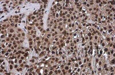 Immunohistochemistry-Paraffin: OCT4 Antibody (486) [NBP2-15052]