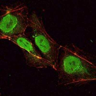 Immunocytochemistry/ Immunofluorescence: OCT4 Antibody (7E7) [NBP1-51664]