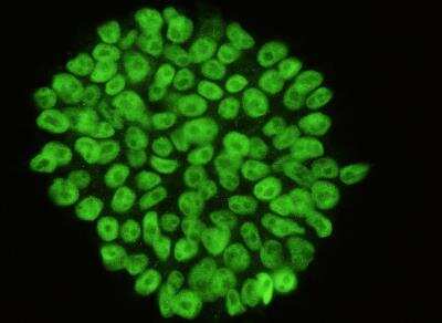 Immunocytochemistry/ Immunofluorescence: OCT4 Antibody [NBP3-05882]