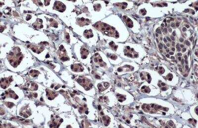 Immunohistochemistry-Paraffin: OCT4 Antibody [NBP2-15053]