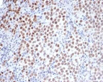 Immunohistochemistry-Paraffin: OCT4 Antibody (OCT4/3508) [NBP3-13744]