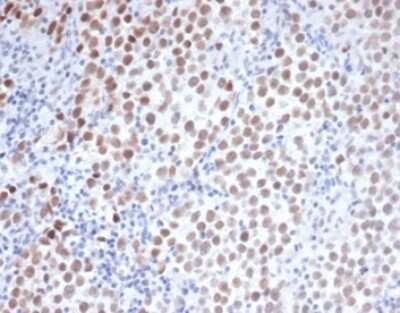 Immunohistochemistry-Paraffin: OCT4 Antibody (OCT4/3508) [NBP3-13744]