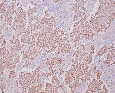 Immunohistochemistry-Paraffin: OCT4 Antibody (OCT4/6875R) [NBP3-13745]