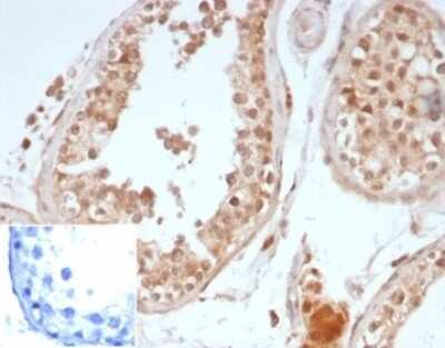 Immunohistochemistry-Paraffin: OCT4 Antibody (OCT4/6875R) [NBP3-13745]