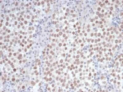 Immunohistochemistry-Paraffin: OCT4 Antibody (OCT4/6875R) [NBP3-13745]