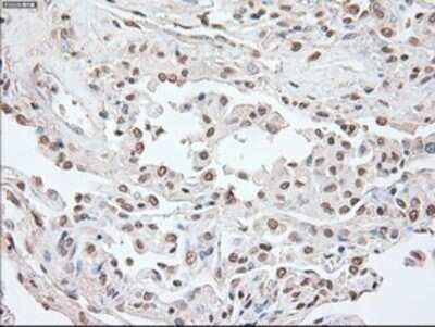 Immunohistochemistry: OCT4 Antibody (OTI9B7) - Azide and BSA Free [NBP2-71225]