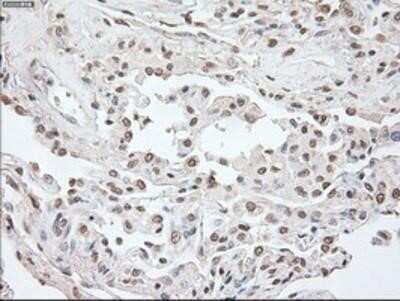 Immunohistochemistry-Paraffin: OCT4 Antibody (OTI9B7) [NBP1-47923]