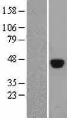 Western Blot: OCT4 Overexpression Lysate [NBL1-14620]