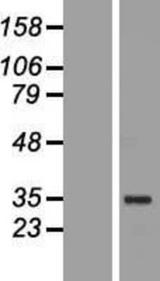 Western Blot: OCT4 Overexpression Lysate [NBP2-04571]