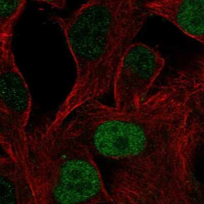 Immunocytochemistry/ Immunofluorescence: OCT6 Antibody [NBP2-58689]