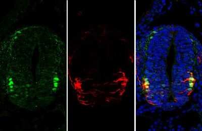 Immunohistochemistry-Paraffin: OCT6 Antibody [NBP3-13349]