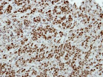 Immunohistochemistry-Paraffin: POU3F2/OCT7 Antibody [NBP2-21585]