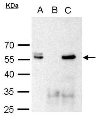 Immunoprecipitation: POU3F2/OCT7 Antibody [NBP2-21585]