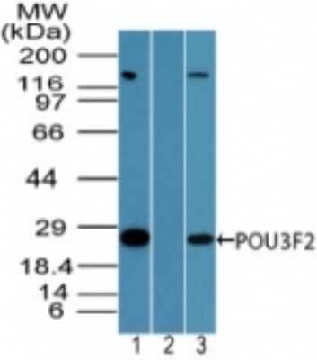 Western Blot: POU3F2/OCT7 Antibody [NBP2-24658]