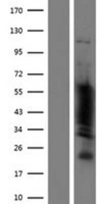 Western Blot: POU3F2/OCT7 Overexpression Lysate [NBP2-10458]