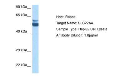 Western Blot: OCTN1/SLC22A4 Antibody [NBP2-87978]