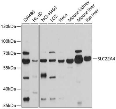 Western Blot: OCTN1/SLC22A4 AntibodyBSA Free [NBP2-94155]