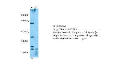 Western Blot: OCTN2/SLC22A5 Antibody [NBP2-83303]