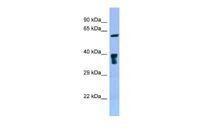 Western Blot: OCTN2/SLC22A5 Antibody [NBP2-83304]