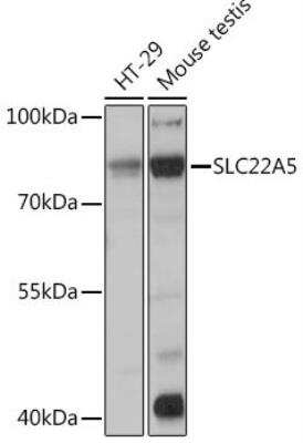 Western Blot: OCTN2/SLC22A5 AntibodyBSA Free [NBP2-94796]