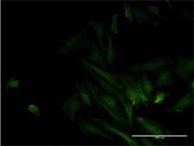 Immunocytochemistry/ Immunofluorescence: ODF2 Antibody (1A1) [H00004957-M01]