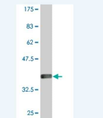 Western Blot: ODF2 Antibody (1A1) [H00004957-M01]