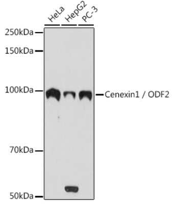 Western Blot: ODF2 Antibody (3Z1H8) [NBP3-16233]