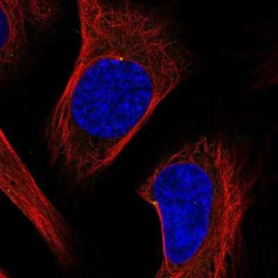 Immunocytochemistry/ Immunofluorescence: ODF2 Antibody [NBP2-58793]