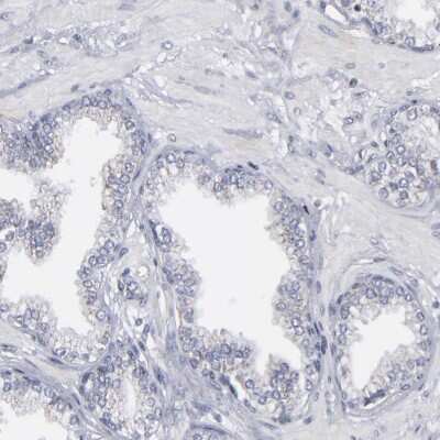 Immunohistochemistry-Paraffin: ODF2 Antibody [NBP1-85417]
