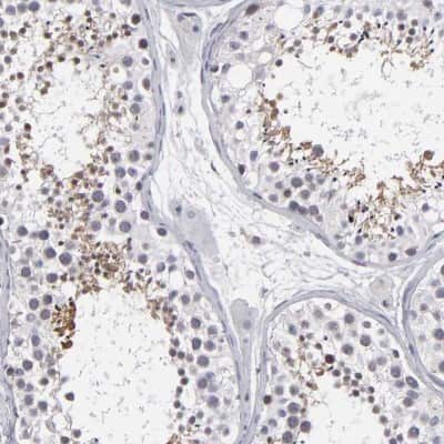 Immunohistochemistry-Paraffin: ODF2 Antibody [NBP1-85417]