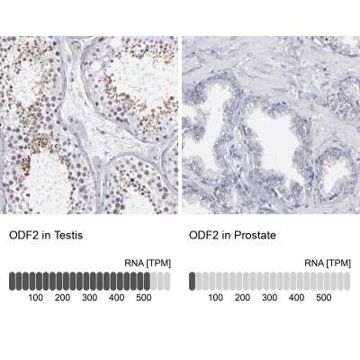 Immunohistochemistry-Paraffin: ODF2 Antibody [NBP1-85417]