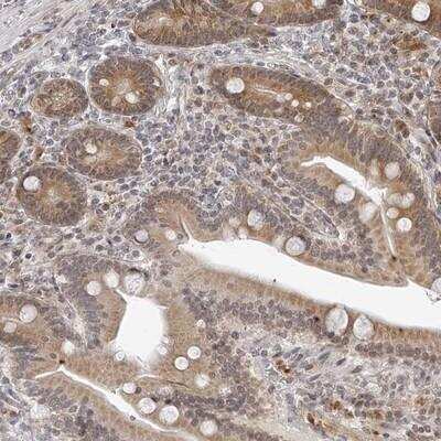 Immunohistochemistry-Paraffin: ODF2L Antibody [NBP1-82921]