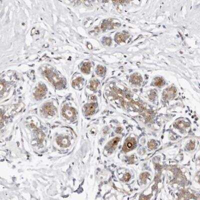 Immunohistochemistry-Paraffin: ODF2L Antibody [NBP1-82922]