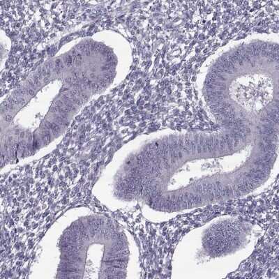 Immunohistochemistry-Paraffin: ODF3 Antibody [NBP1-90614]