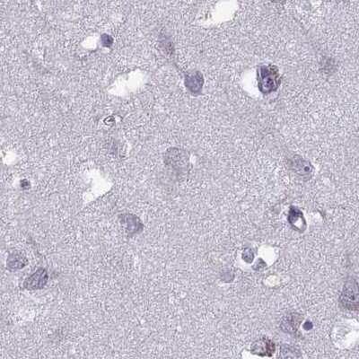 Immunohistochemistry-Paraffin: ODF3 Antibody [NBP1-90614]