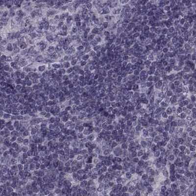 Immunohistochemistry-Paraffin: ODF3 Antibody [NBP1-90614]