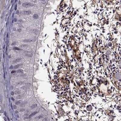 Immunohistochemistry-Paraffin: ODF3 Antibody [NBP1-90614]