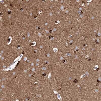 Immunohistochemistry-Paraffin: ODF3 Antibody [NBP2-32628]