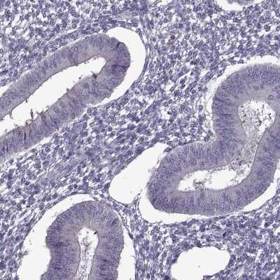 Immunohistochemistry-Paraffin: ODF3 Antibody [NBP2-32628]