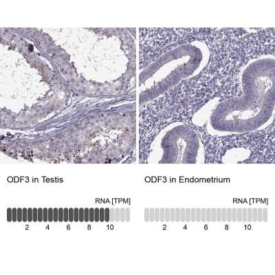 Immunohistochemistry-Paraffin: ODF3 Antibody [NBP2-32628]