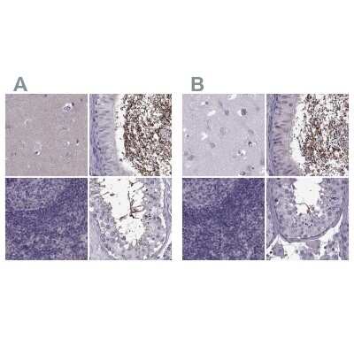 Immunohistochemistry-Paraffin: ODF3 Antibody [NBP2-32628]